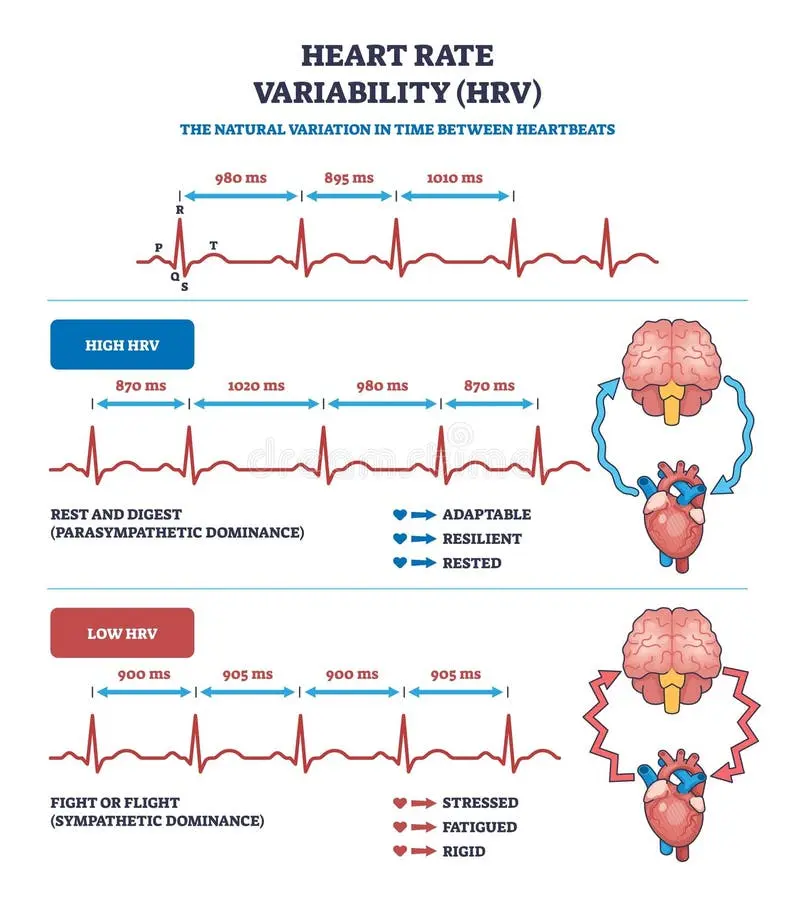نمودار تغییرات ضربان قلب در HRV با خطوط ECG و نمادهای مغز نشان‌دهنده حالت‌های مختلف