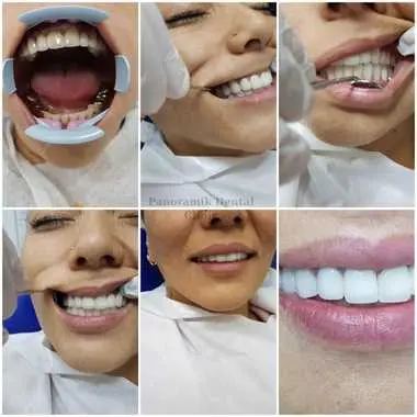نمای کامپوزیت با طراحی سه‌بعدی و شبیه‌سازی سنگ طبیعی